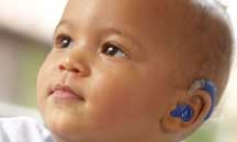 photo of infant wearing Hearing aid